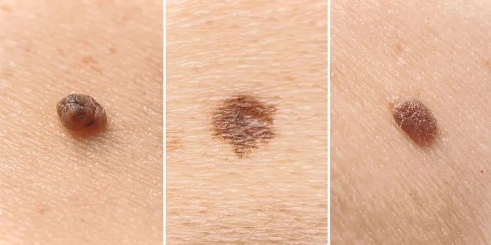 どのような症状がありますか?